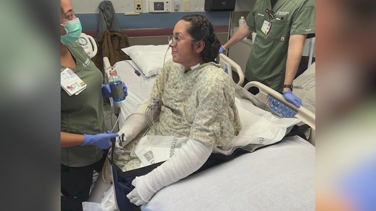 California Mom Loses All Her Limbs From Bacterial Infection