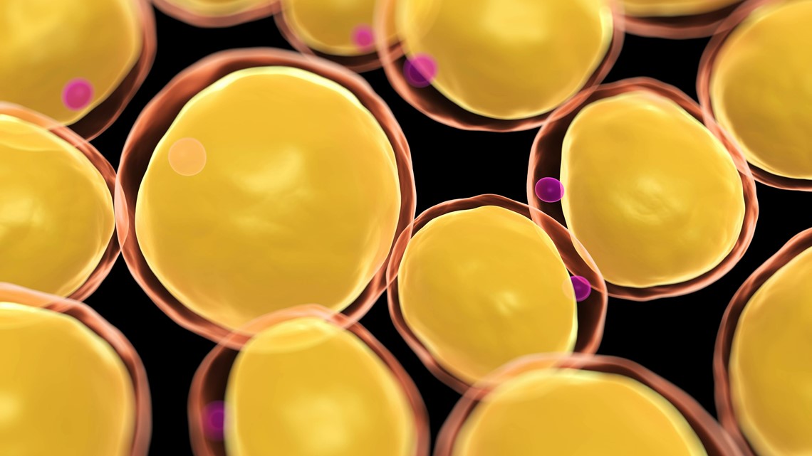 COVID disimpan dalam sel lemak: Apa yang dikatakan penelitian baru