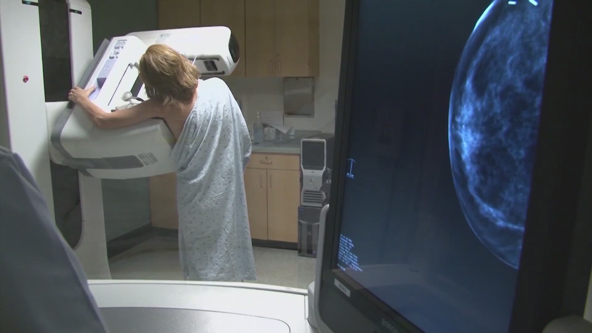 A mammogram can detect cancer years before physical symptoms, such as lumps, develop.