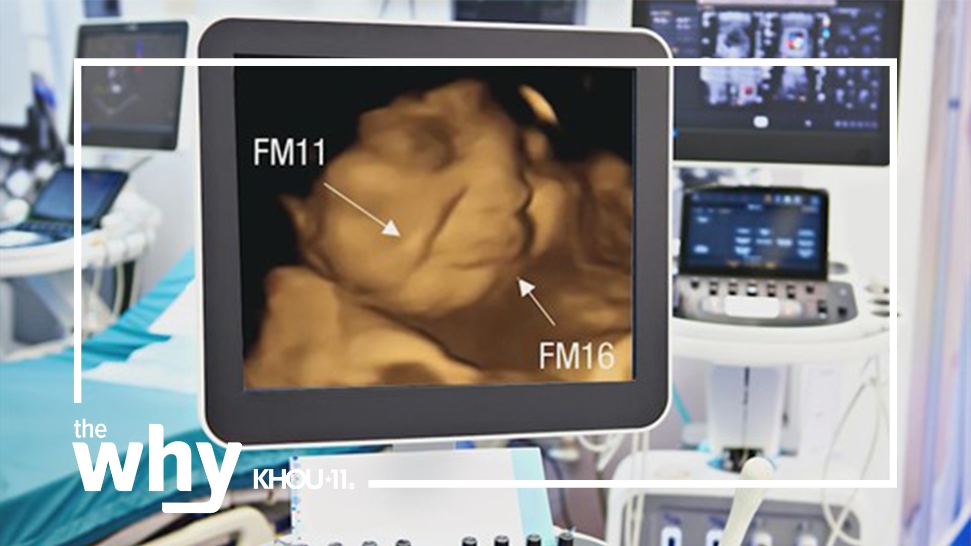 A new study used ultrasounds to get fetal reactions to vegetables.