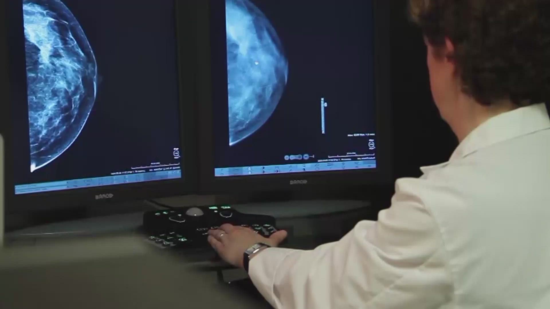 Mammograms for women at average risk for breast cancer should start earlier