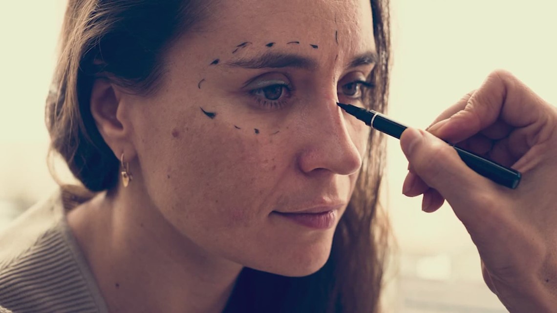 Zoom Dysmorphia People make permanent face changes