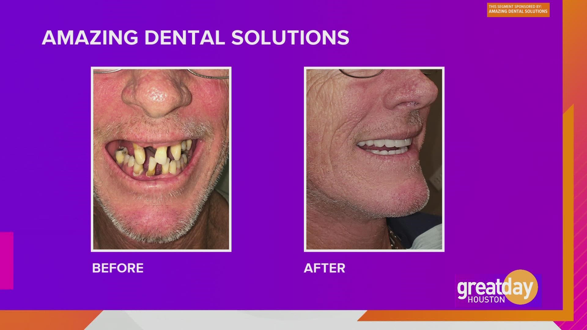 Dr. Amaning with Amazing Dental Solutions shares some good news on how a full mouth makeover can transform more than just your bite!