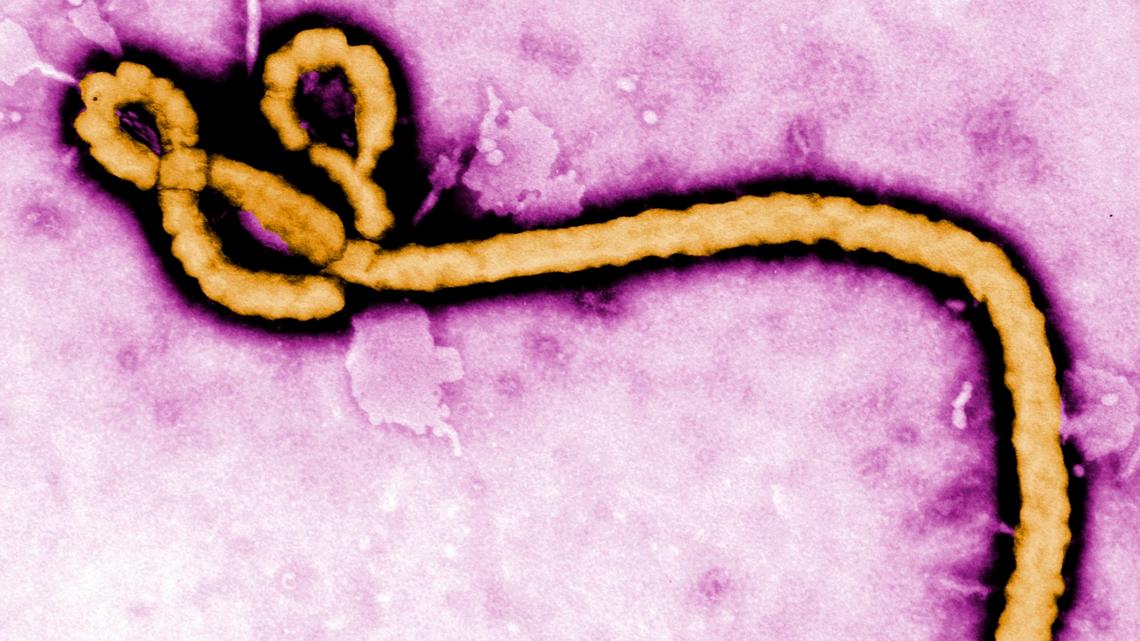 Concerned about Ebola? Here's how you can track it in Houston