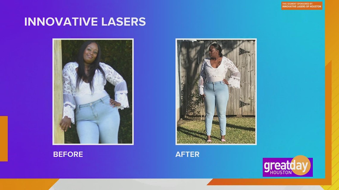 Laser Inovatif dari Houston dapat membantu Anda menurunkan berat badan yang tidak diinginkan