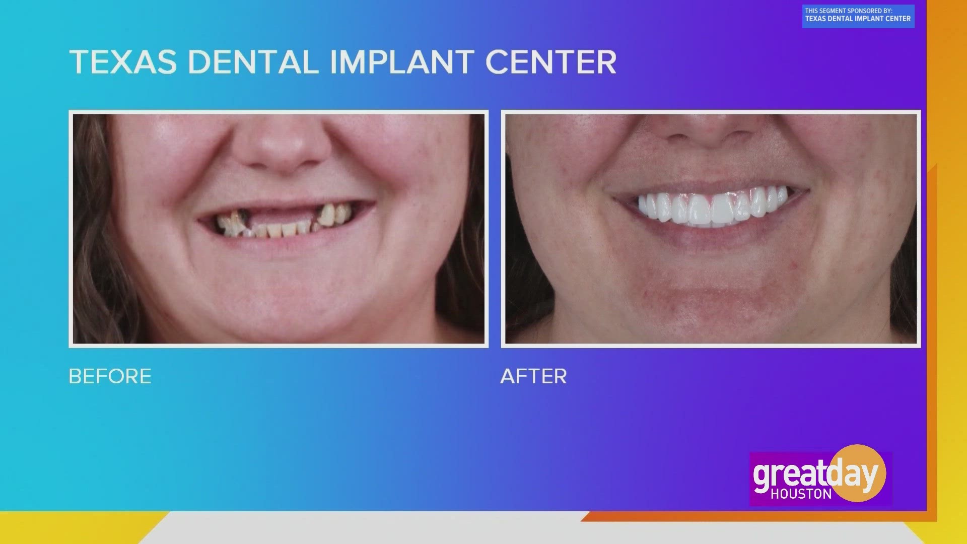 The Texas Dental Implant Center can help you transform your smile so you can say goodbye to missing and failing teeth.