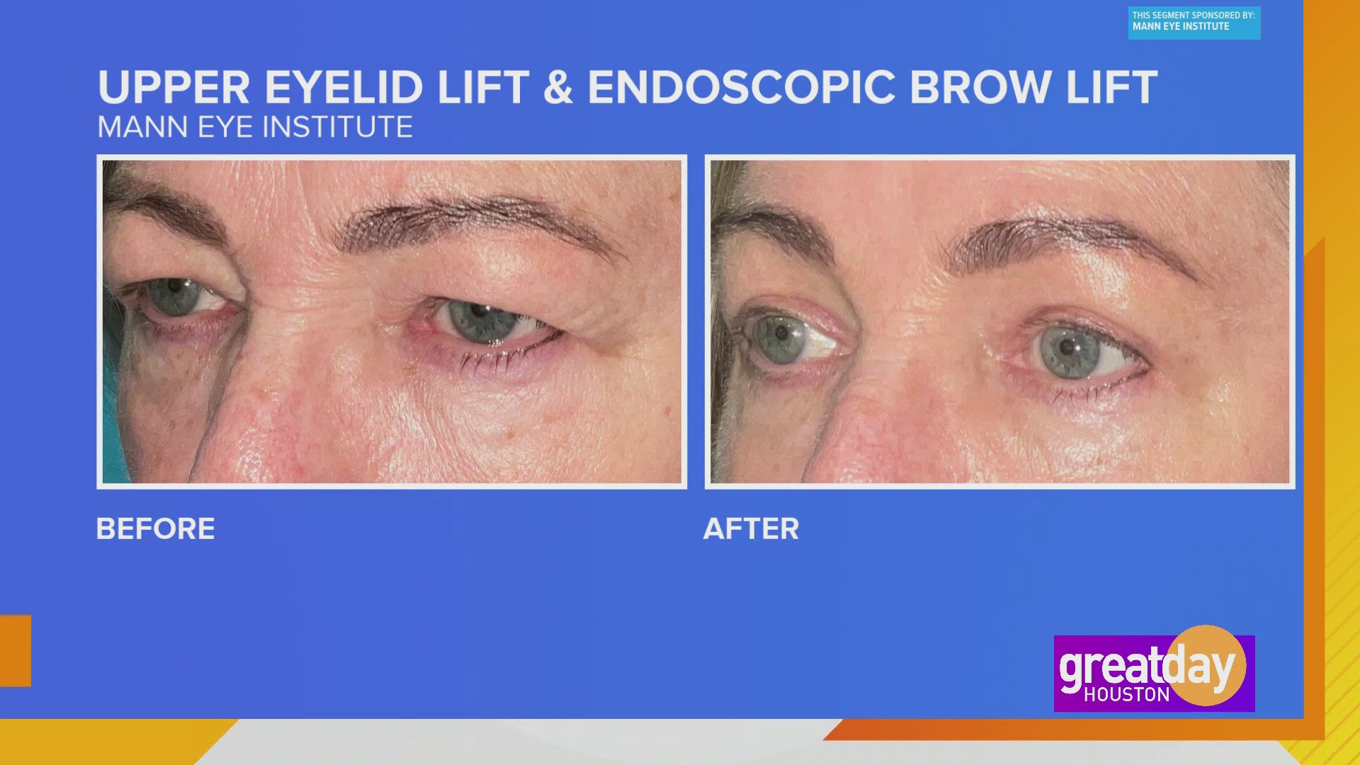 At Mann Eye Institute, you can take care of both the form and function of your eyes, all in one place! 