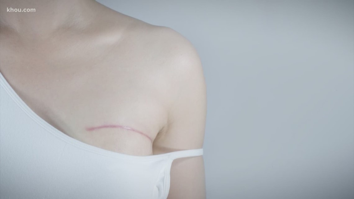 The decision to undergo a mastectomy is deeply personal for each patient.