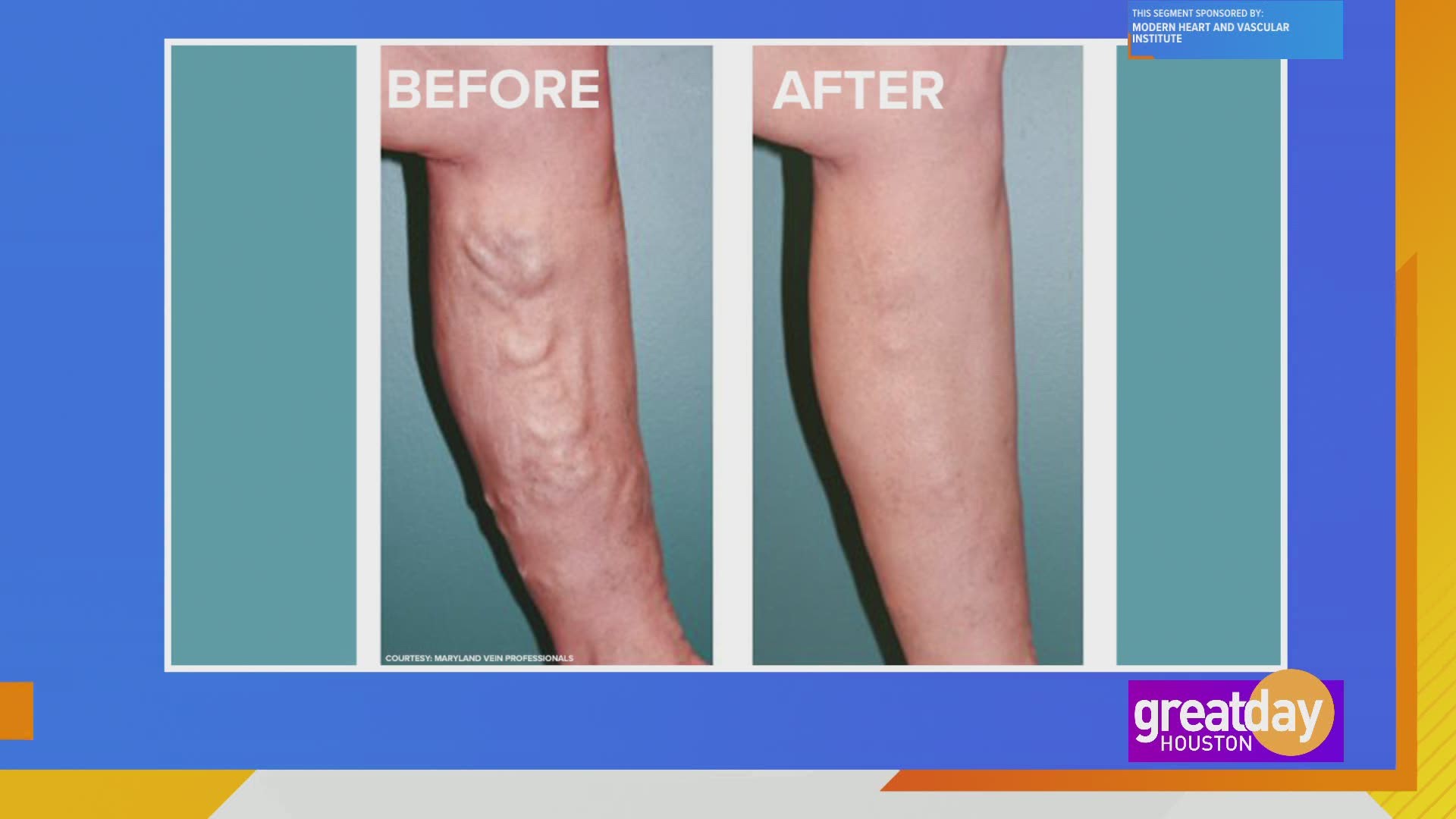 Symptoms And Treatment For Poor Circulation In Your Veins Khou