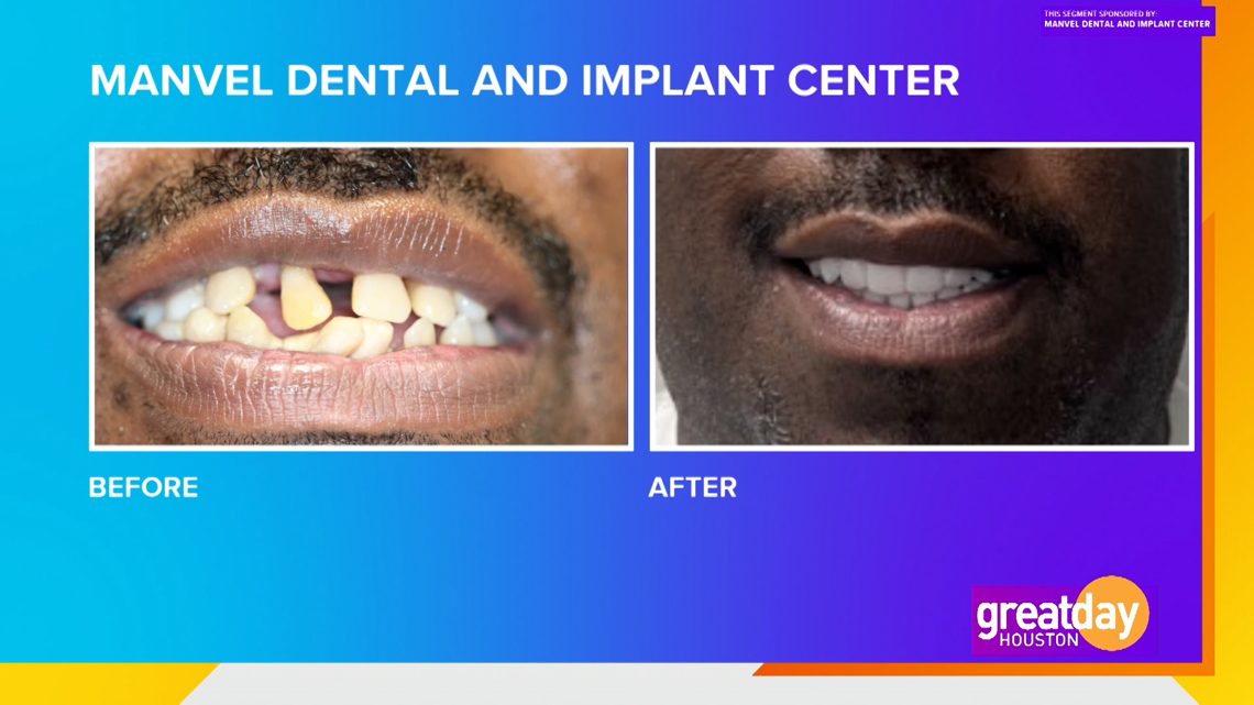 Sponsored Saddle Up & Smile Wide with Manvel Dental & Implant Center