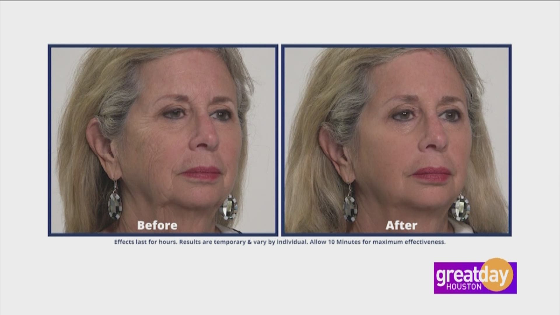 Plexaderm takes years off your face by making under-eye bags and age lines disappear in just minutes.  Melinda McKinsey showed Deborah Duncan its incredible results.