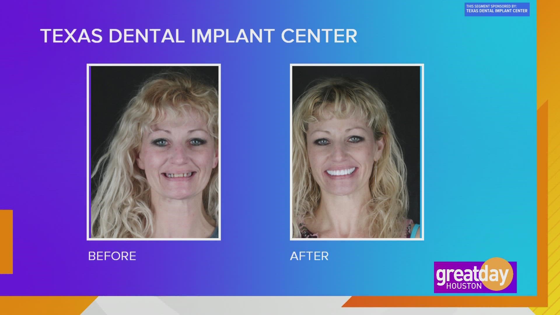 No more hiding behind your smile! Dr. Michel Azer with the Texas Dental Implant Center, shares how his office can transform your smile and your confidence!