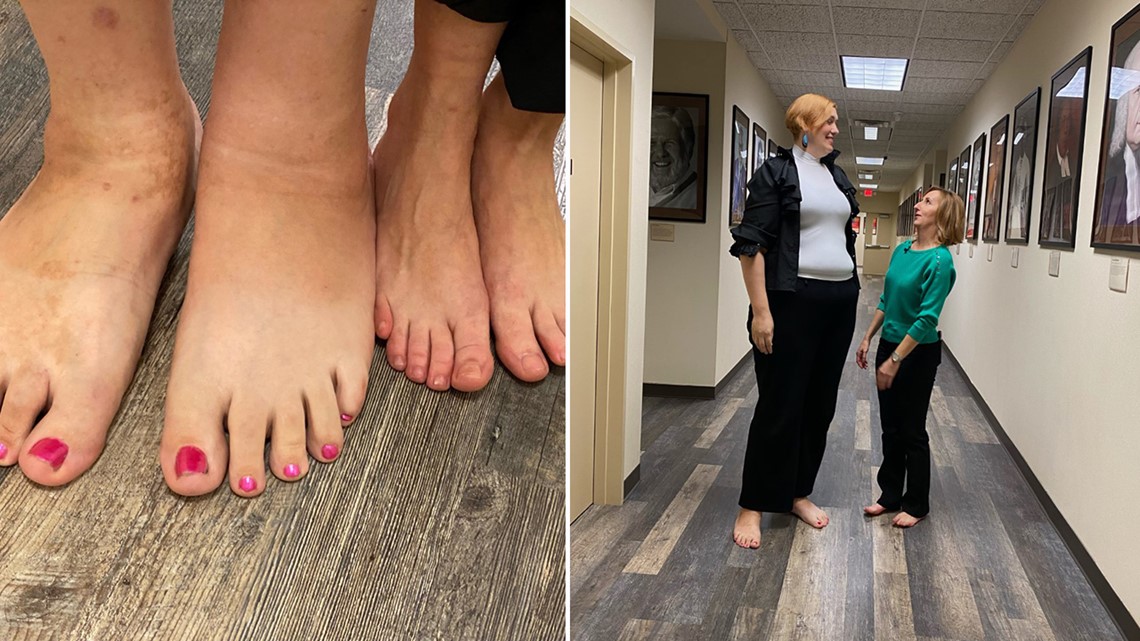 Wanita di daerah Houston memiliki kaki wanita terbesar di dunia, per Guinness