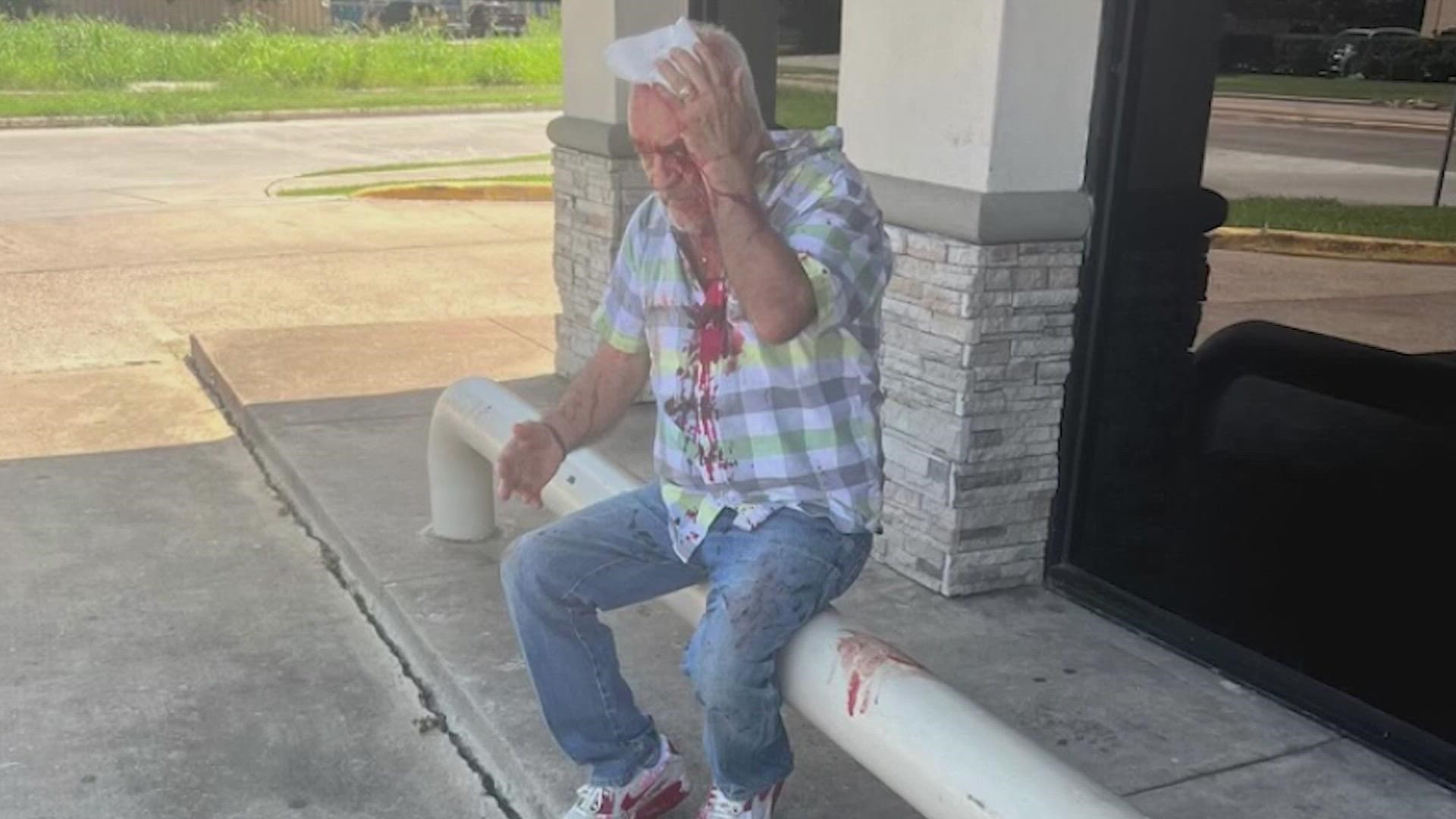 The Houston grandpa of 11 was forced out of his truck and pistol-whipped when he stopped to help a woman being robbed. He punched the robber before he got away.