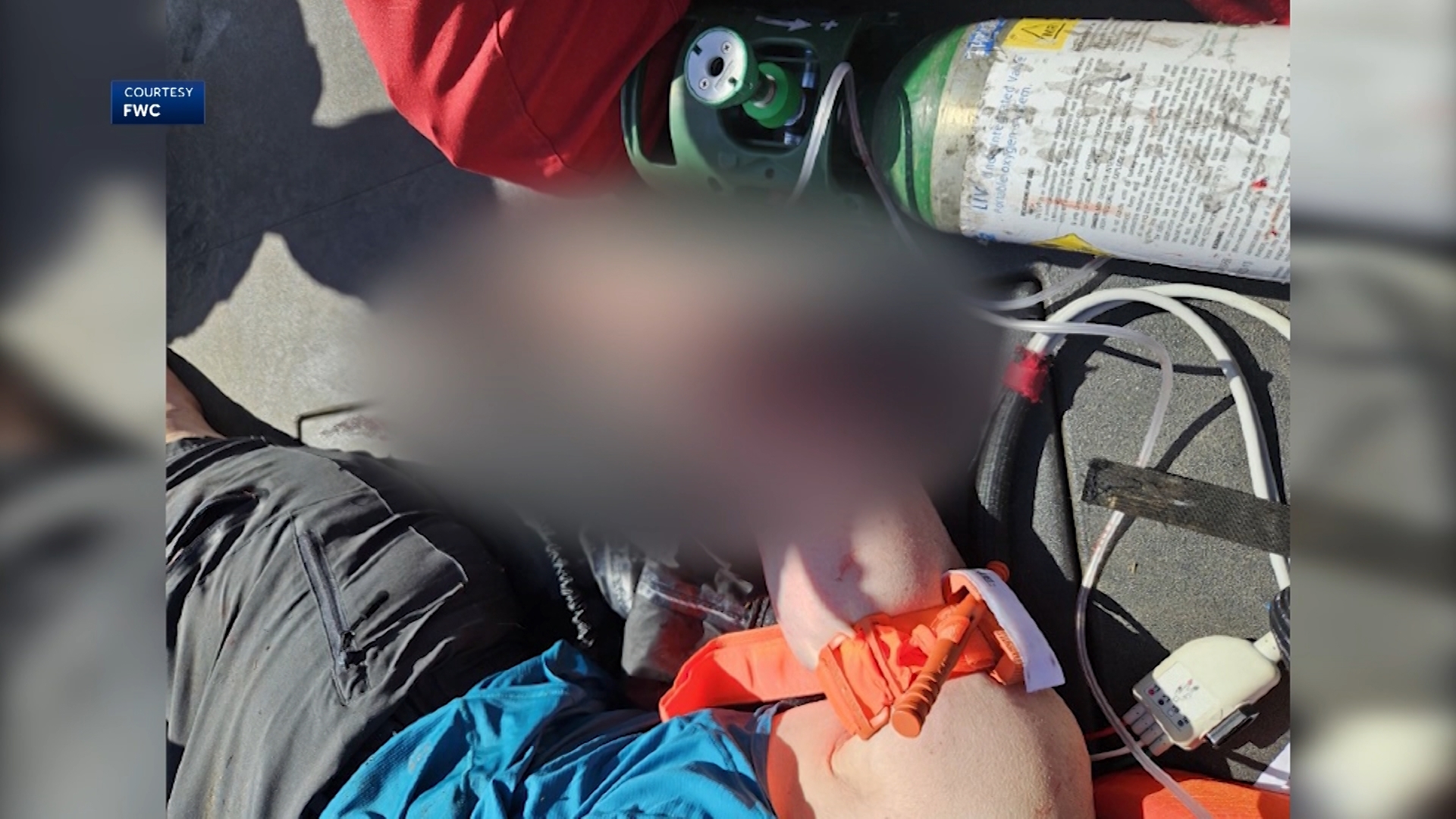 A Texas woman was severely injured after an alligator attack during a group kayaking trip in Florida. Experts say it was likely a defensive response.