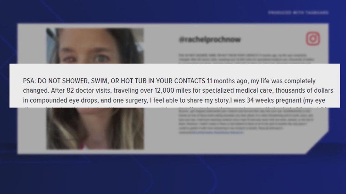 Texas woman has message for contact wearers after getting permanent infection