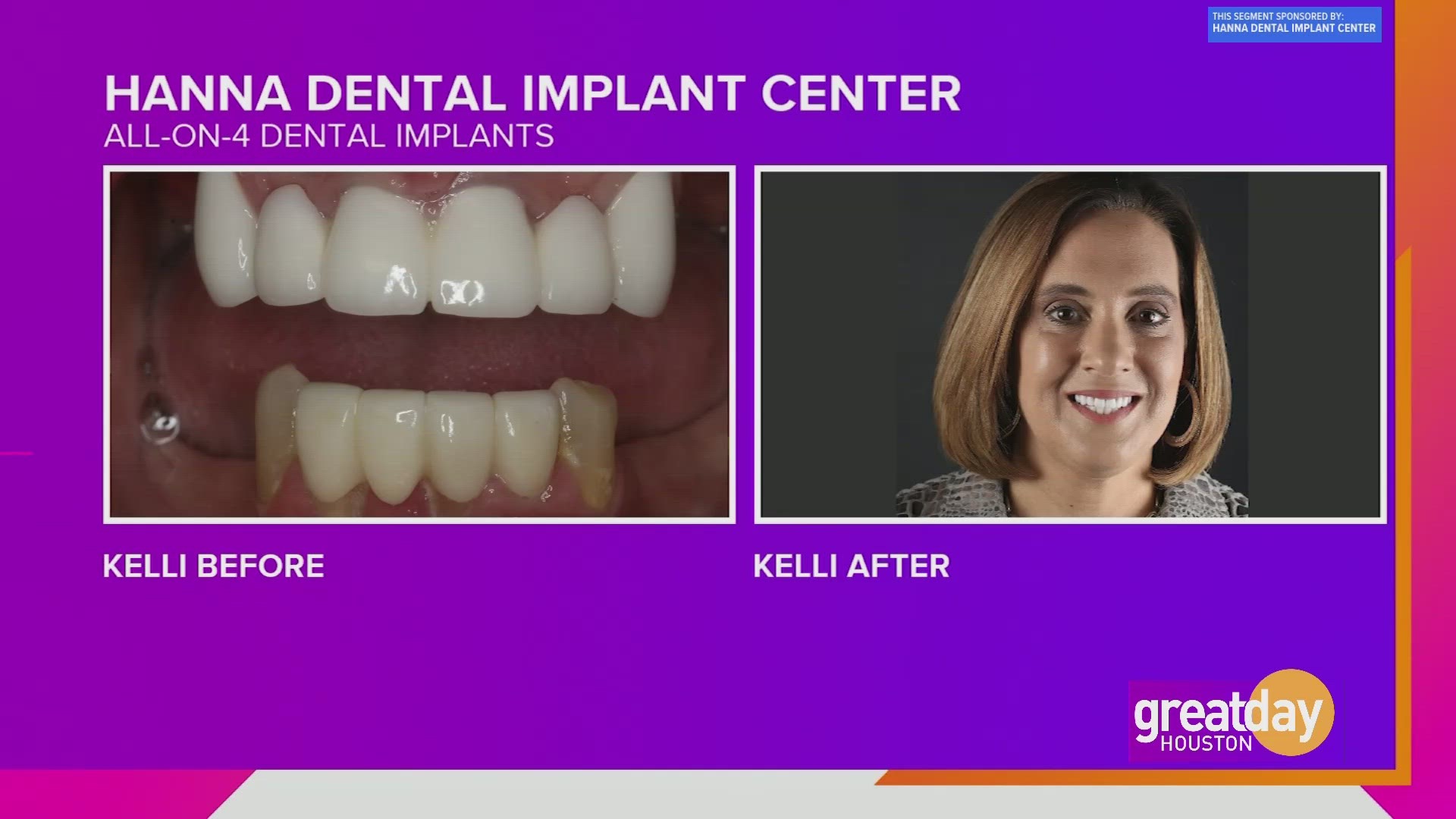 Dr. Raouf Hanna changed the life of Kelli Griffith after she endured 25 years of dental pain.