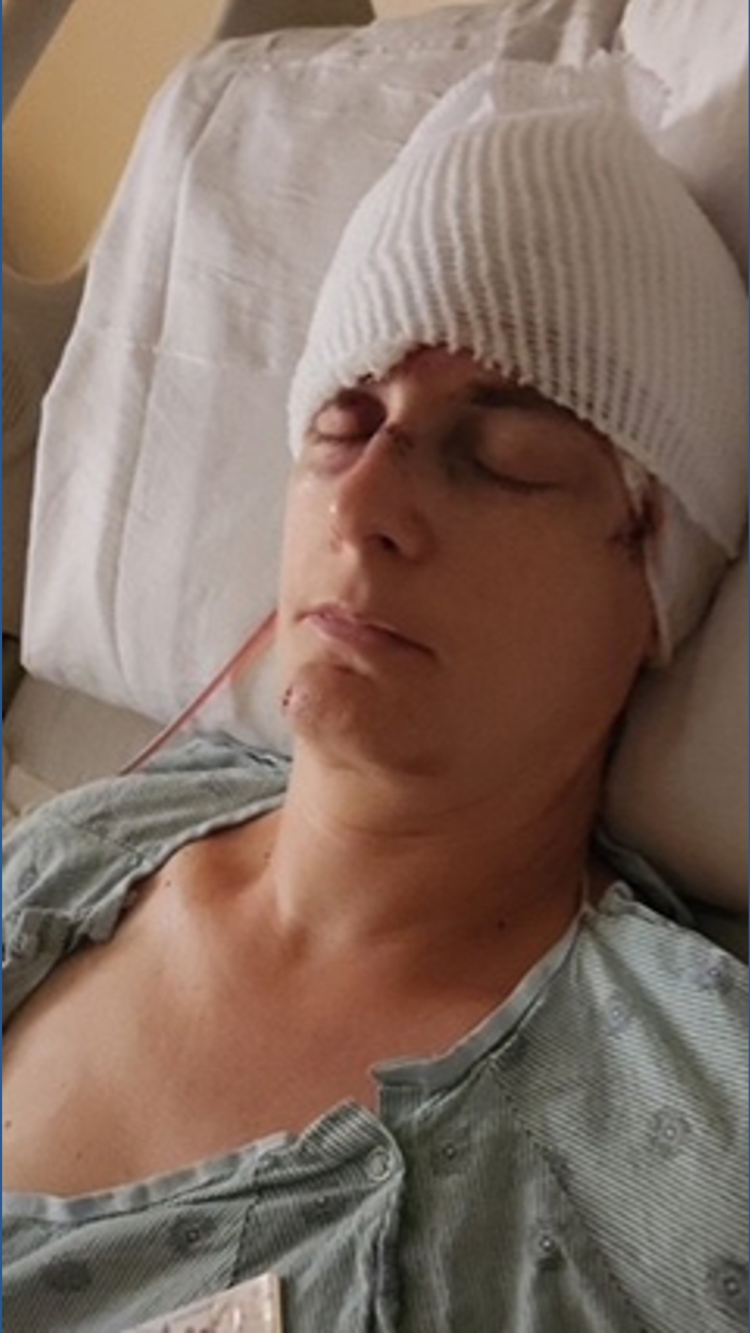 Texas woman airlifted to Houston after dog attack | khou.com