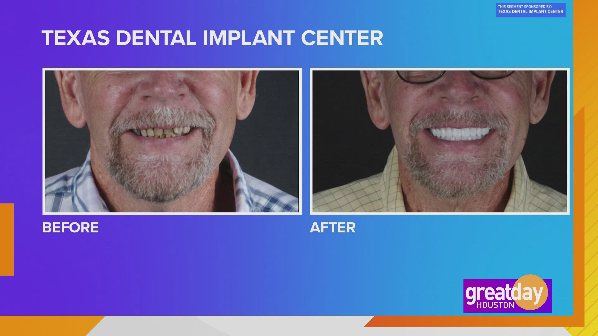 Let the Texas Dental Implant Center give you the smile and confidence of your dreams.