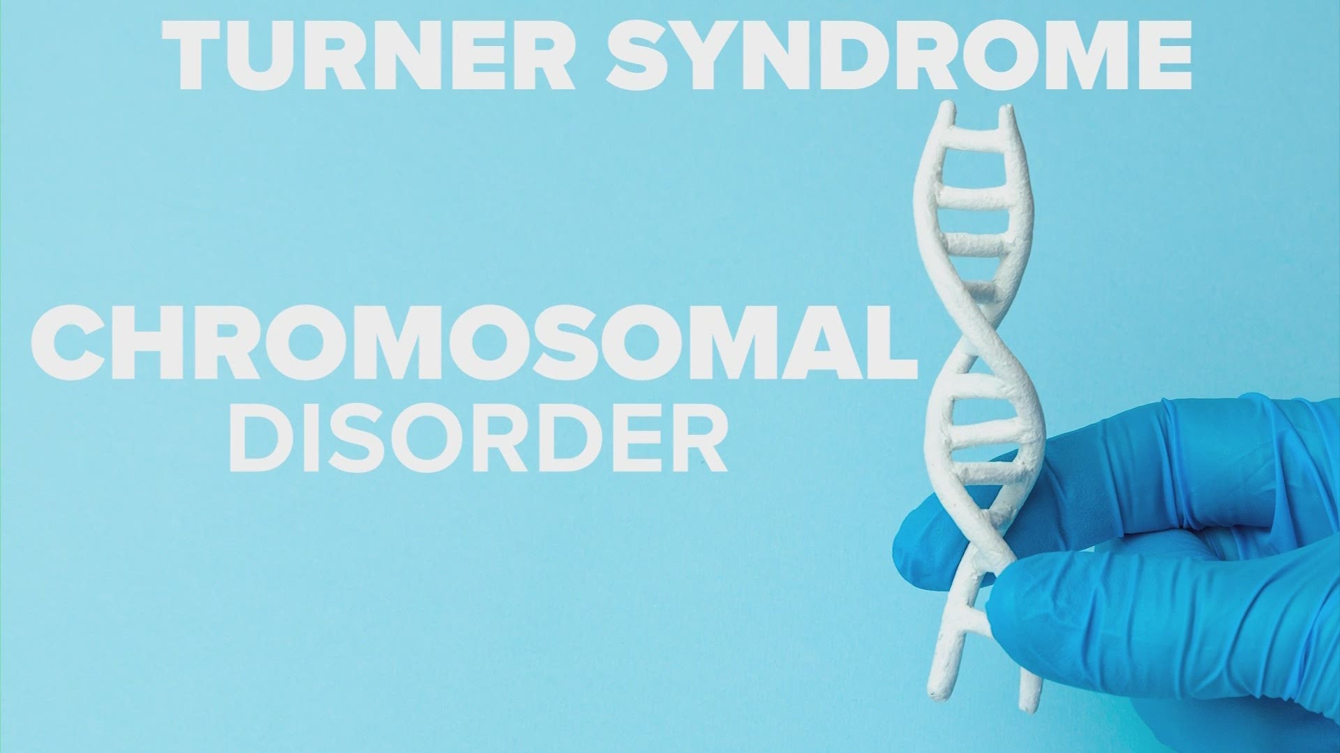 UT Physicians has a care center that treats Turner Syndrome, a rare disease that affects only women.