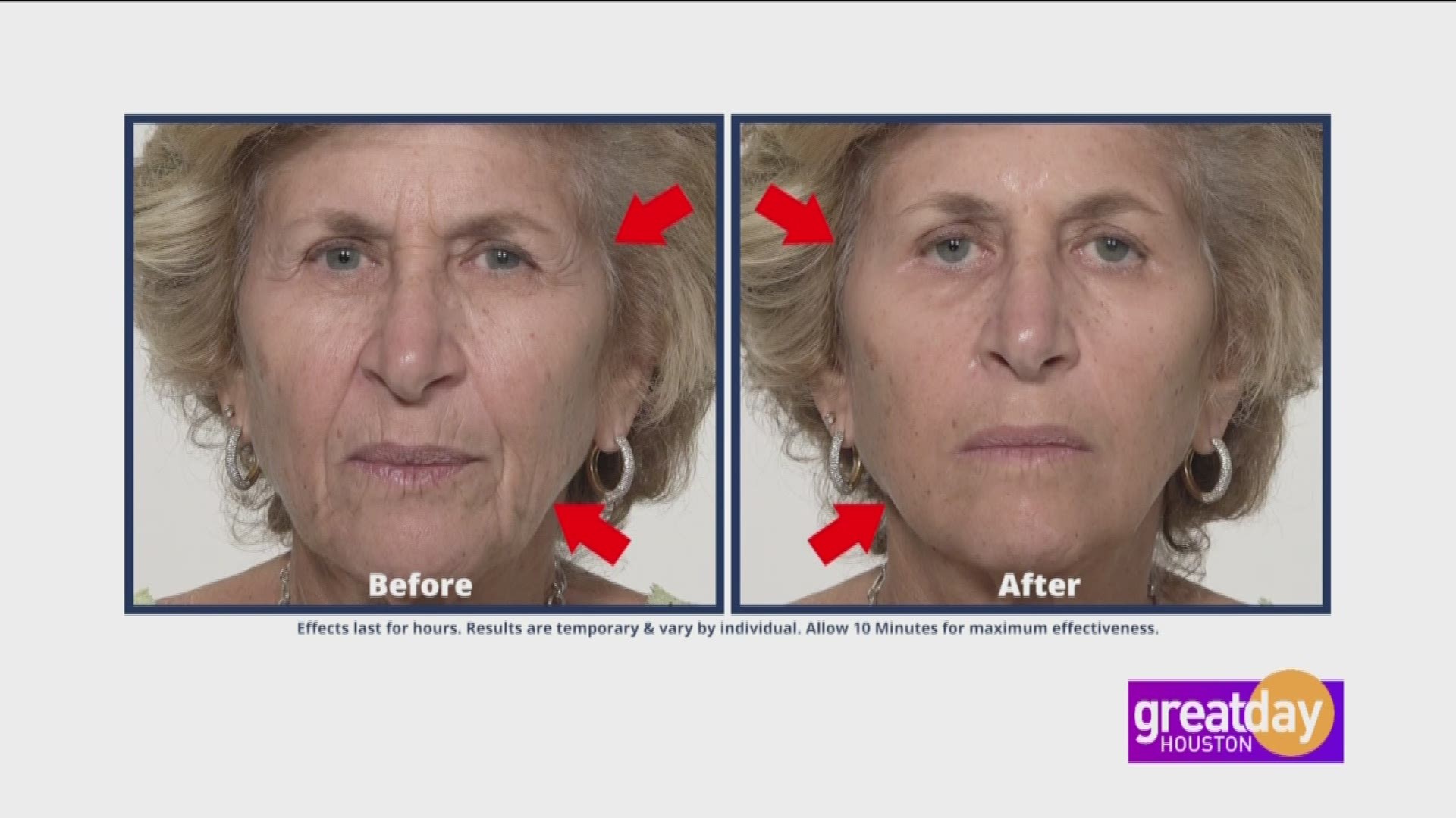 Plexaderm takes years off your face by making under eye bags and age lines disappear in just minutes.  Melinda McKinsey showed Deborah Duncan its incredible results.