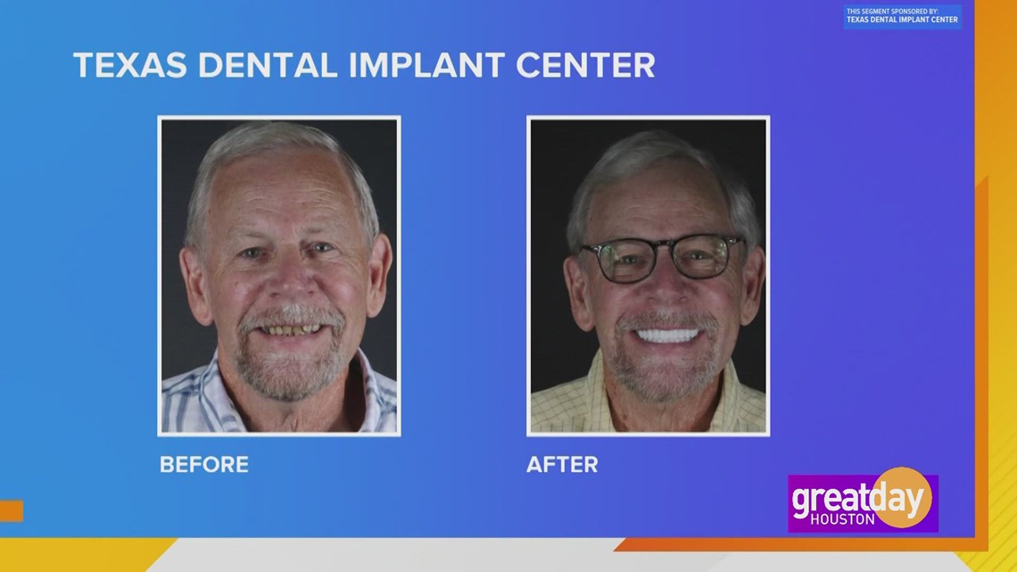 Sponsored Gain the confidence to smile again when you visit Texas