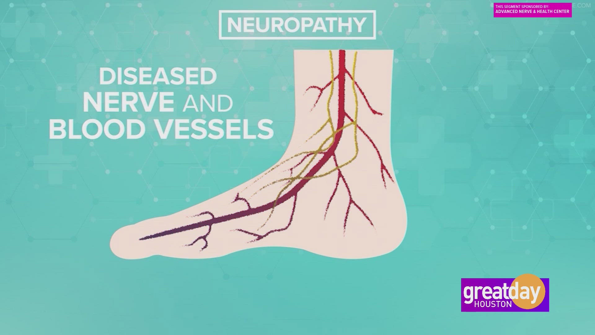 Stop the debilitating symptoms of neuropathy. Make a change today with help from Advanced Nerve and Health Center.