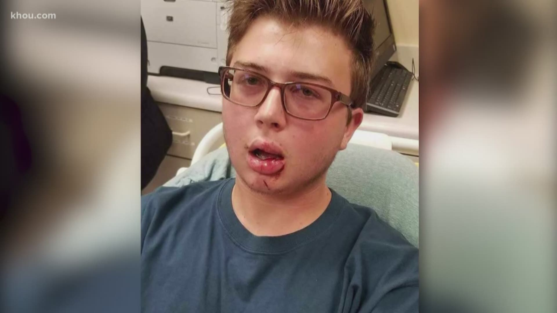 A college student is recovering after he was hit by a foul ball at Minute Maid Park on Saturday night during the Houston Astros game against the New York Yankees.