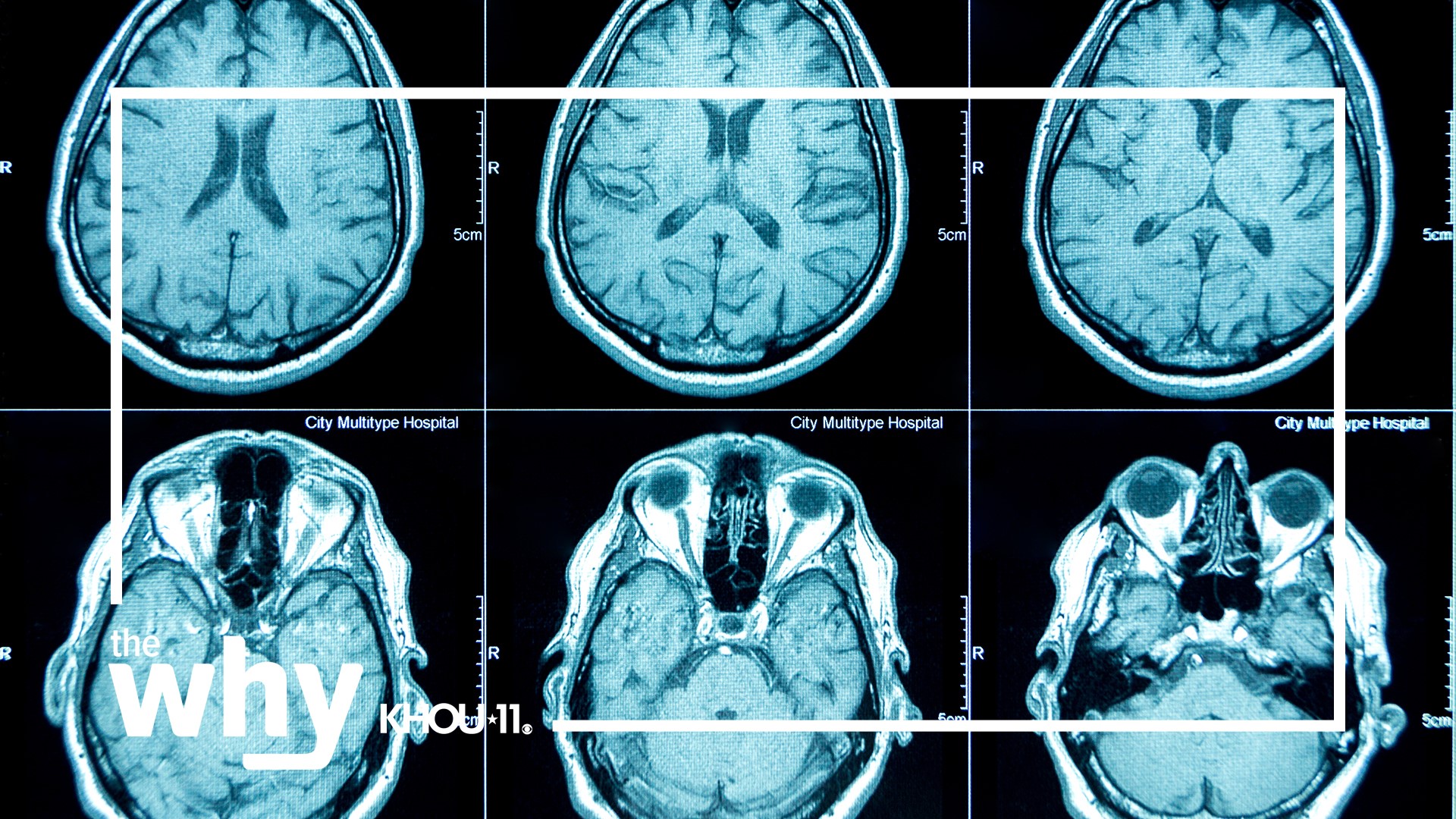 Why Social Media Use Is Linked To Brain Changes In Teens Khou