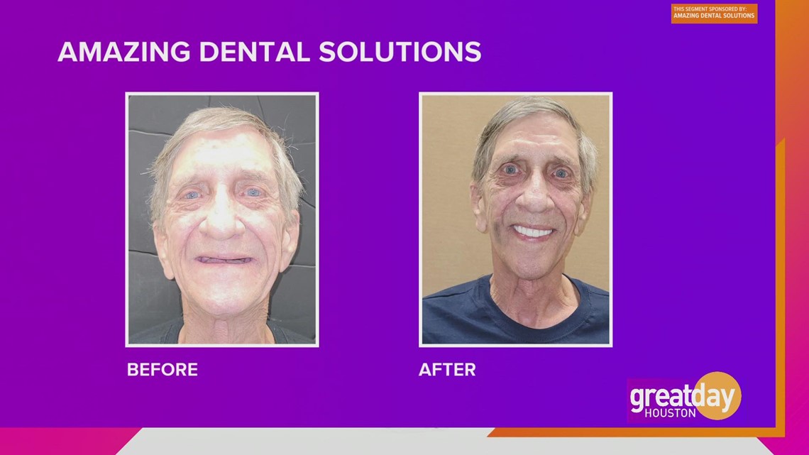 Transform your smile with help from Amazing Dental Solutions