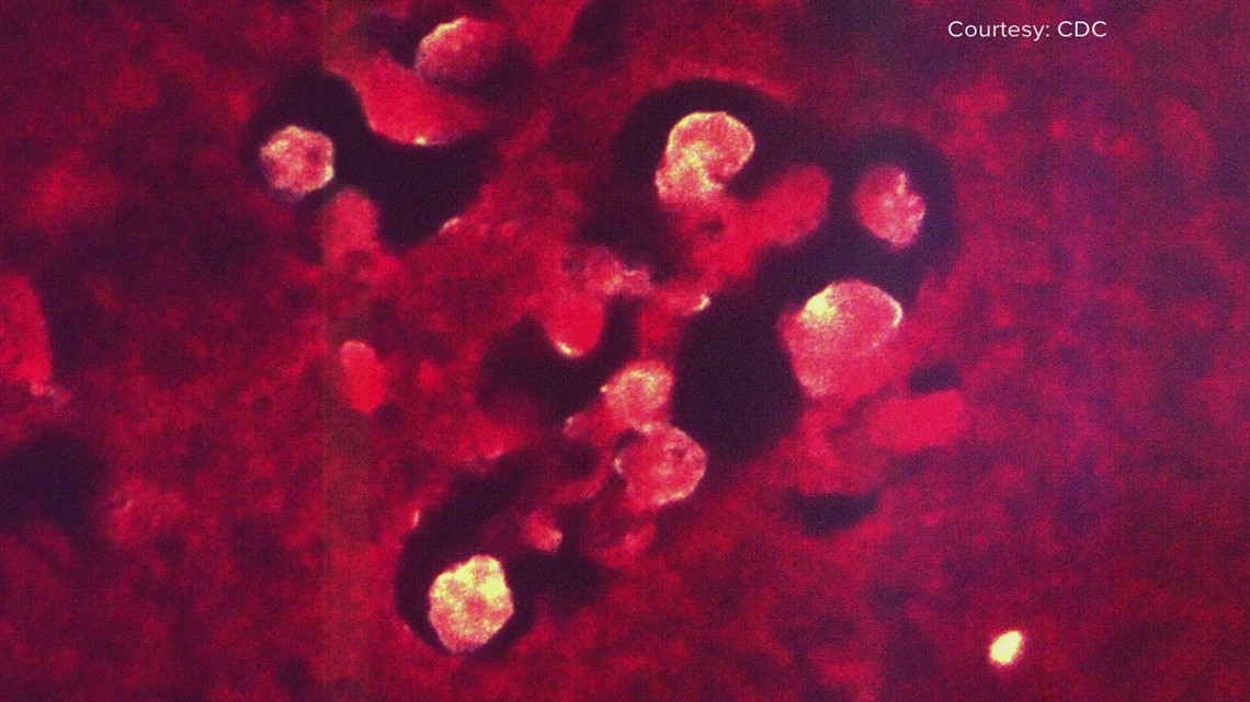 Arkansan baby dies due to brain-eating amoeba at splash pad - Vimarsana News