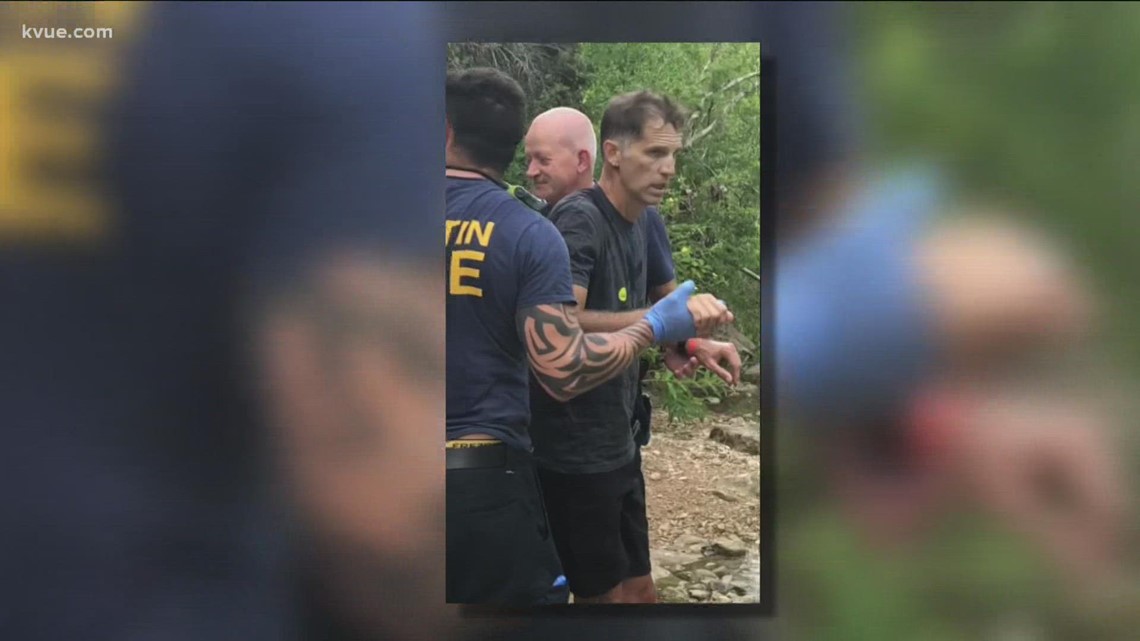 Pengunjung Austin yang pulih dari gigitan copperhead memperingatkan orang lain menjelang akhir pekan Hari Buruh