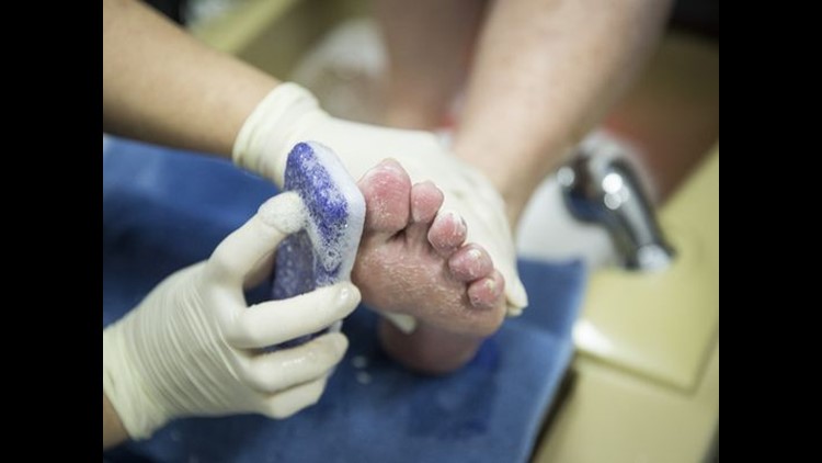 A pedicure cost a man his big toe, another had to get 5 surgeries