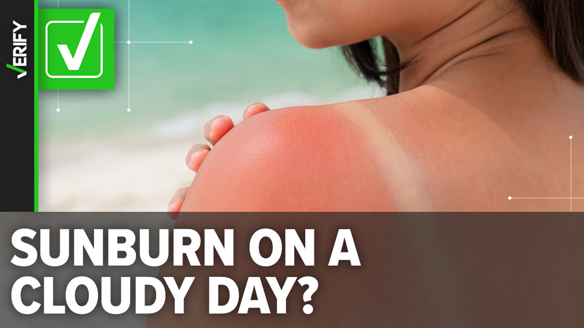 It is possible to get a sunburn even on a cloudy day