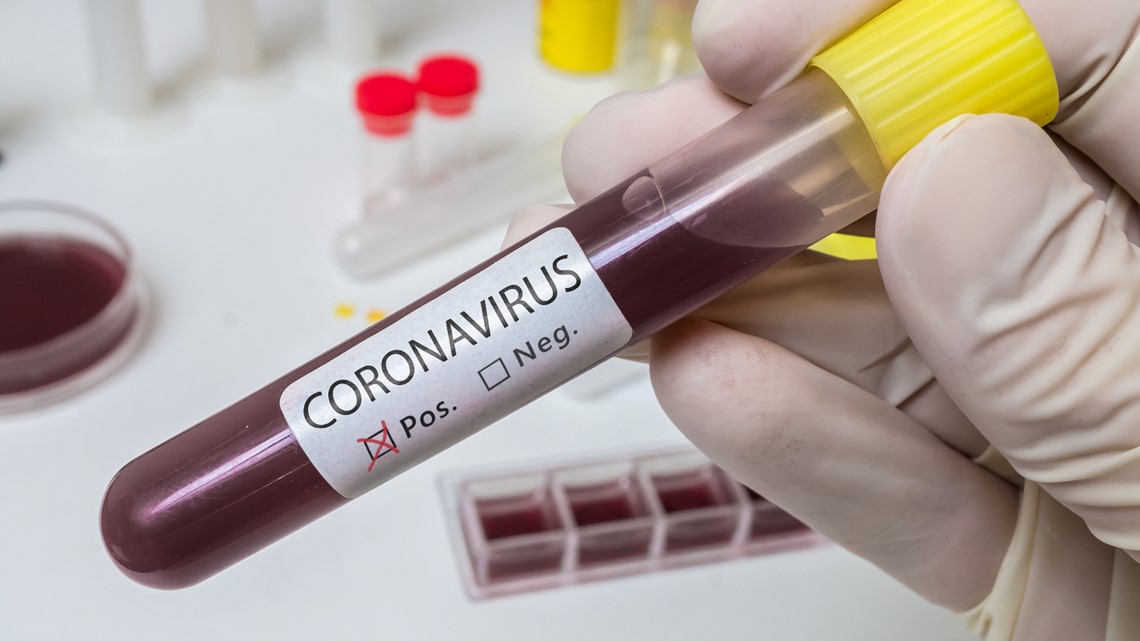 Blood Type And Coronavirus Studies Link Blood Type To Severeity Khou Com   74474891 F31a 44fb 8e20 600c6dfab6db 1140x641 