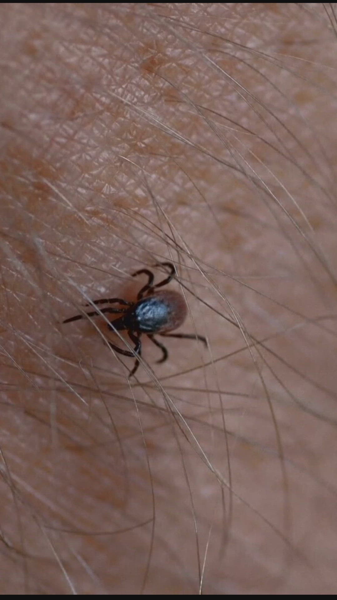 Tick borne Illnesses Are On The Rise Khou tick-borne-illnesses-are-on-the-rise-khou