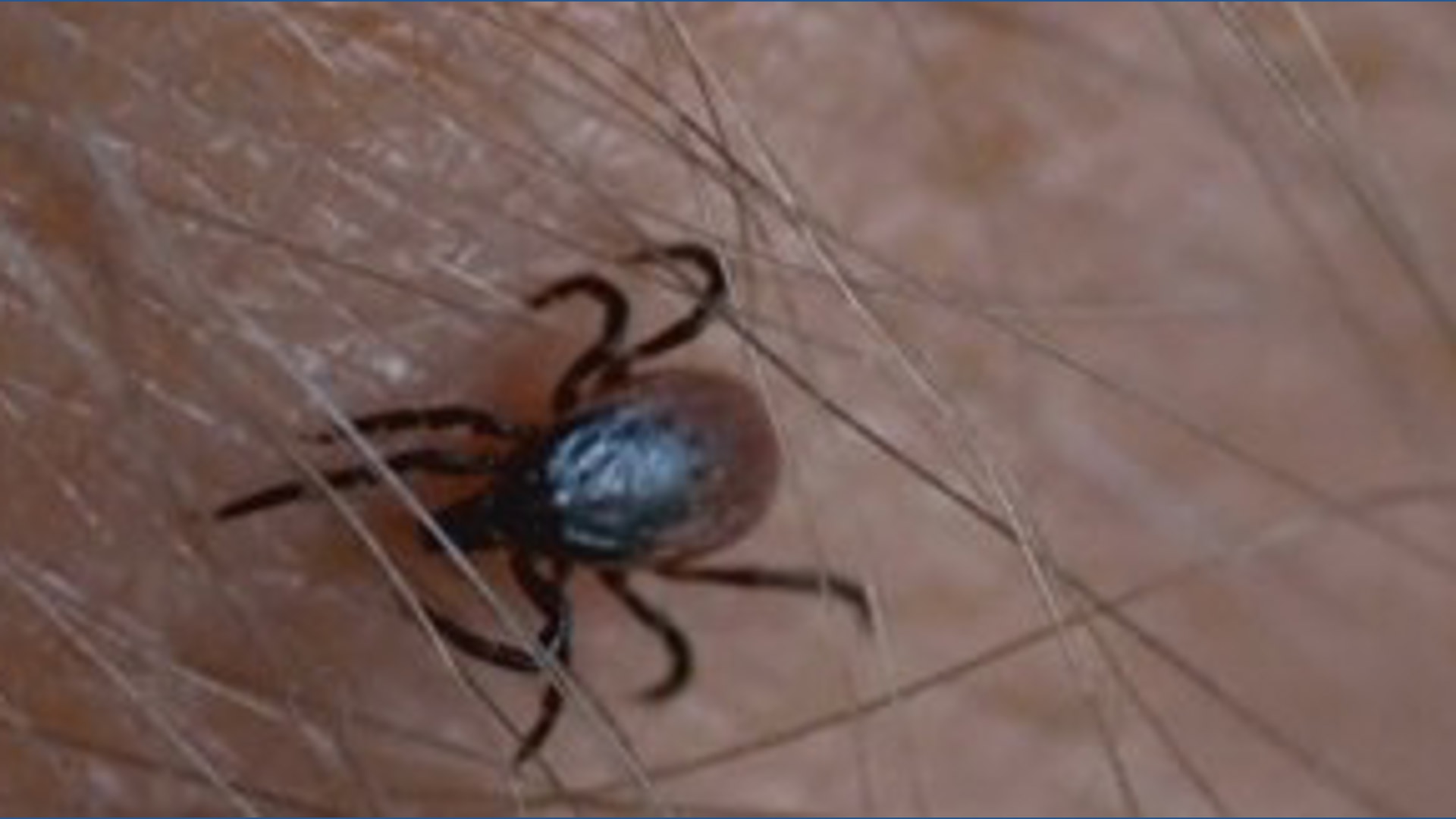 Tick borne Illnesses Are On The Rise Khou tick-borne-illnesses-are-on-the-rise-khou