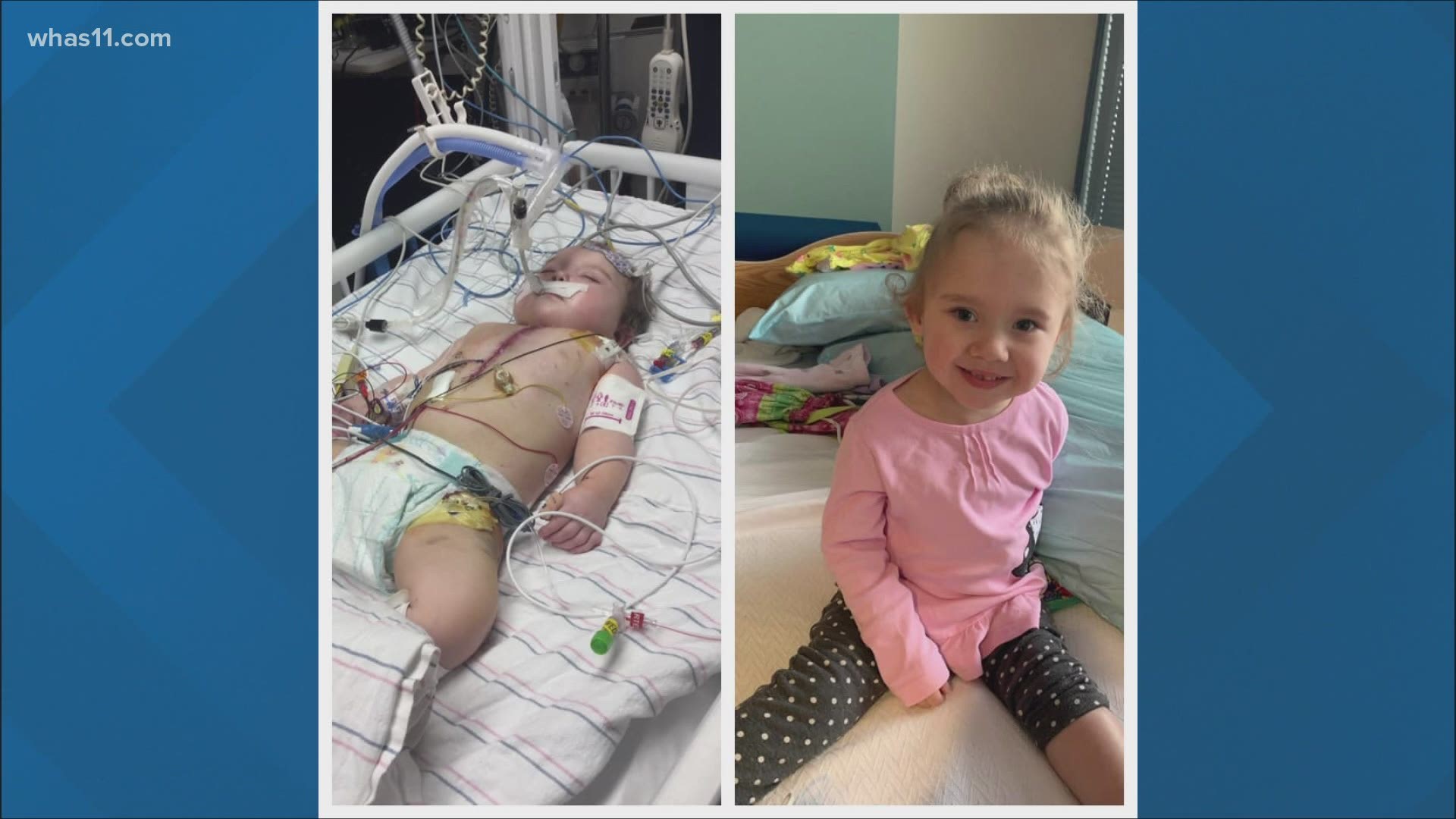 At 16 months old, she had a life saving surgery but the time since has showed it takes more than one surgery to help someone thrive.