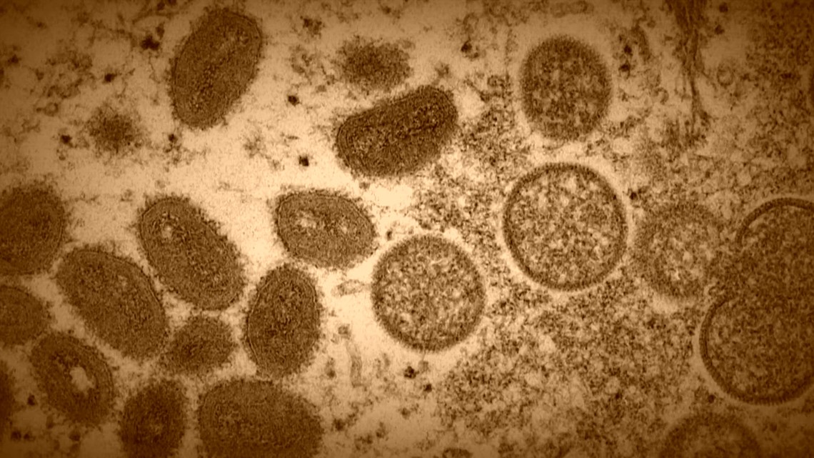 CDC memperingatkan kebangkitan mpox