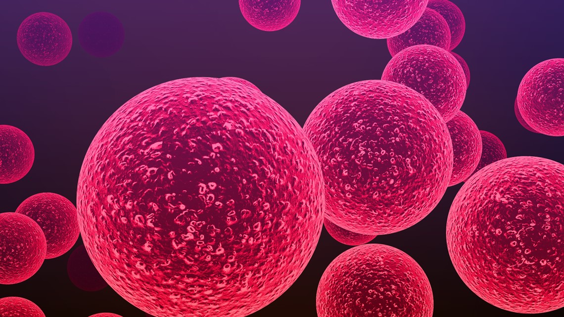 Florida 11-year-old dies from rare flesh-eating bacteria: reports - Vimarsana News