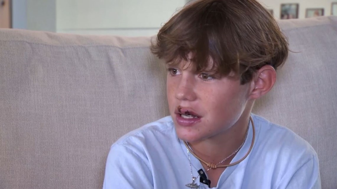Anak 13 tahun digigit hiu saat liburan keluarga di Florida Keys