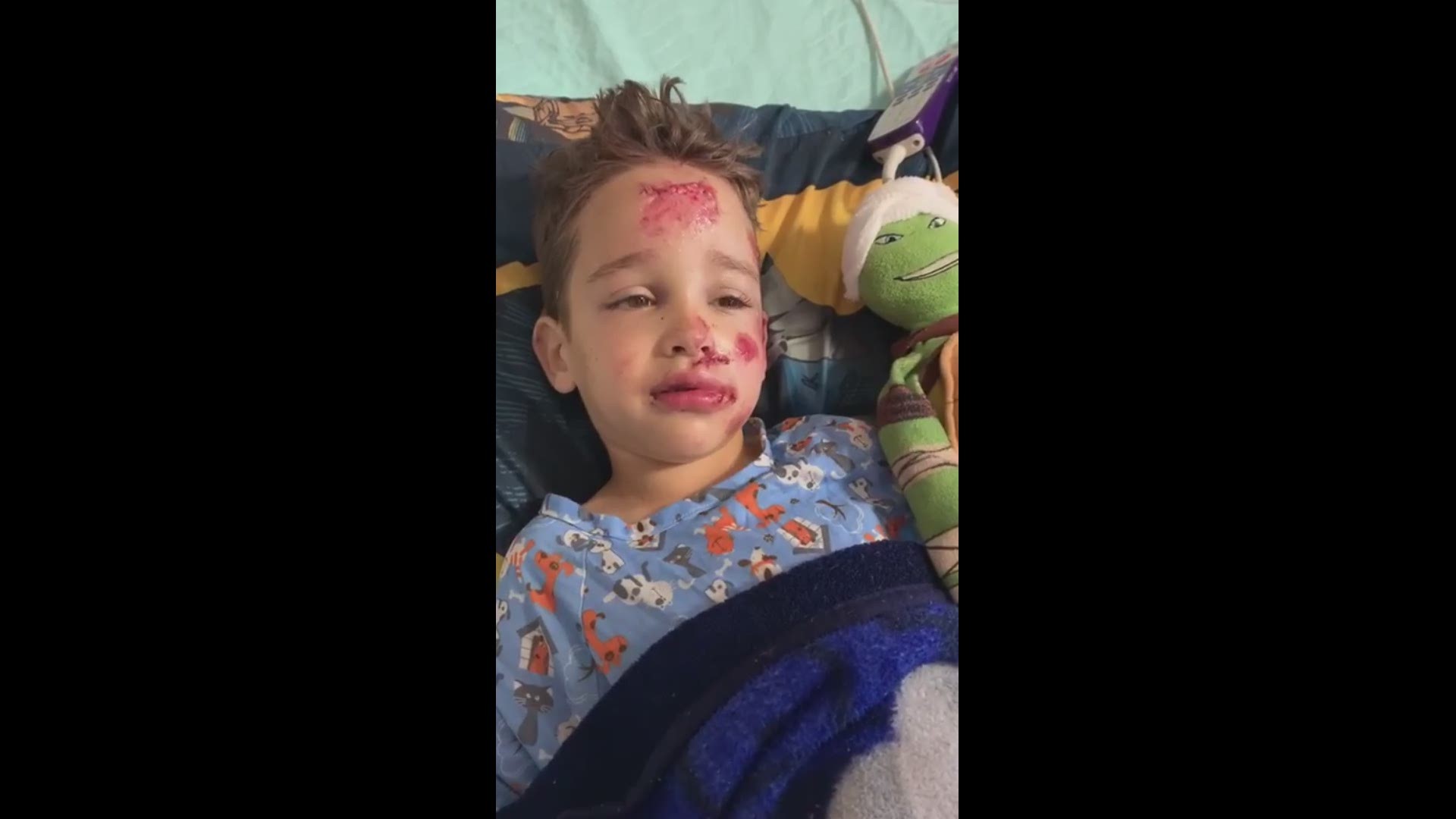 6-year-old hit by car while trick-or-treating thanks everyone for the love