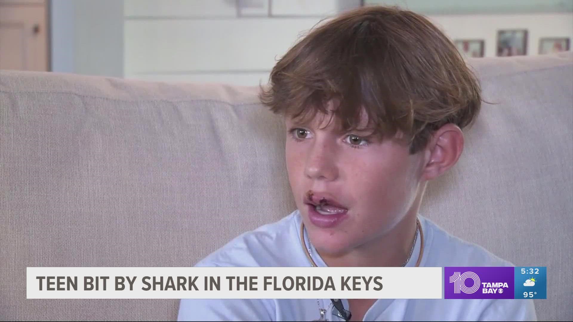 The teen says he was attacked by a nurse shark, a species usually known to be docile.