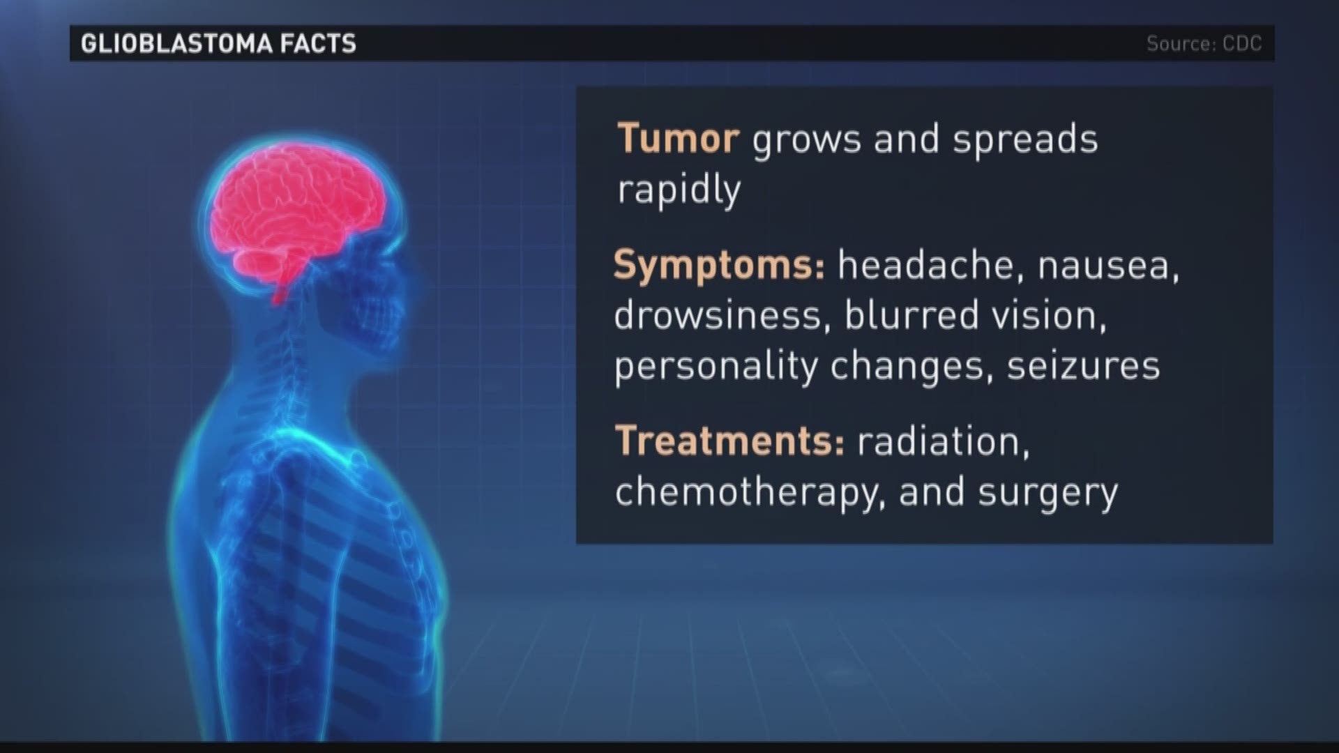 13News Now anchor Regina Mobley spoke with Doctor Wylie Zhu, Chief of Neurosurgery at Sentara about glioblastoma.